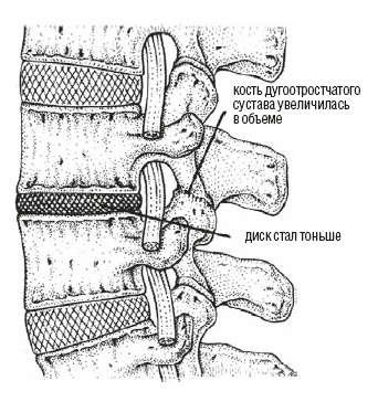 Иллюстрация к книге — Настольная книга для тех, у кого болит спина [i_005.jpg]