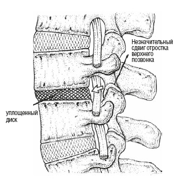 Иллюстрация к книге — Настольная книга для тех, у кого болит спина [i_006.jpg]
