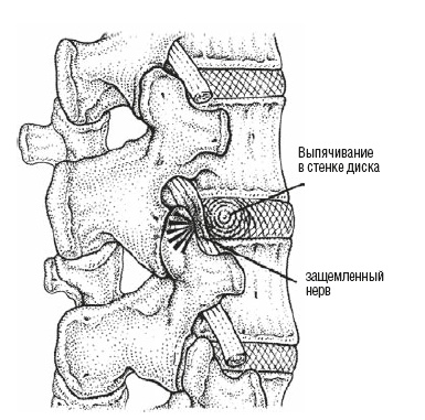 Иллюстрация к книге — Настольная книга для тех, у кого болит спина [i_007.jpg]