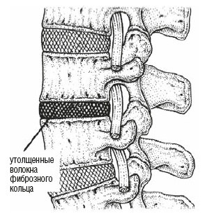 Иллюстрация к книге — Настольная книга для тех, у кого болит спина [i_036.jpg]