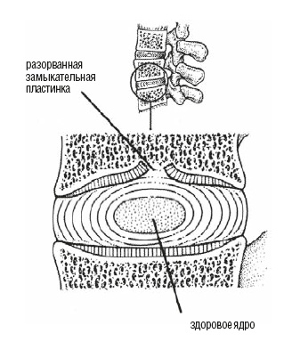 Иллюстрация к книге — Настольная книга для тех, у кого болит спина [i_045.jpg]