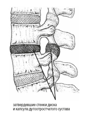 Иллюстрация к книге — Настольная книга для тех, у кого болит спина [i_072.jpg]