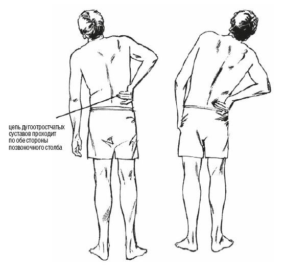 Иллюстрация к книге — Настольная книга для тех, у кого болит спина [i_081.jpg]