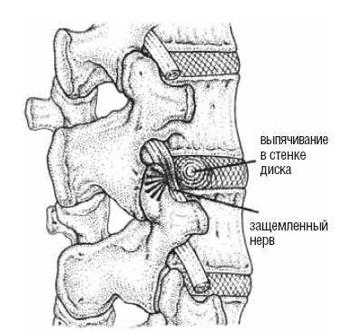 Иллюстрация к книге — Настольная книга для тех, у кого болит спина [i_131.jpg]
