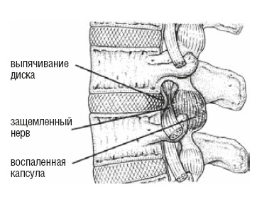 Иллюстрация к книге — Настольная книга для тех, у кого болит спина [i_135.jpg]
