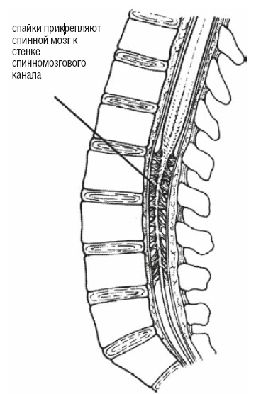 Иллюстрация к книге — Настольная книга для тех, у кого болит спина [i_146.jpg]