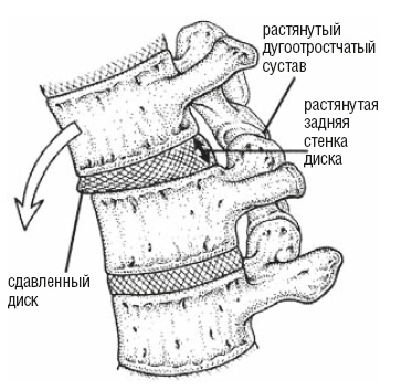 Иллюстрация к книге — Настольная книга для тех, у кого болит спина [i_164.jpg]