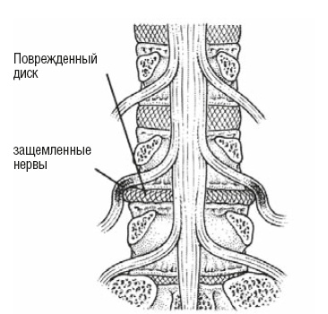 Иллюстрация к книге — Настольная книга для тех, у кого болит спина [i_165.jpg]