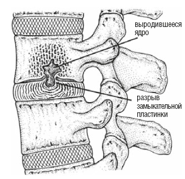 Иллюстрация к книге — Настольная книга для тех, у кого болит спина [i_166.jpg]