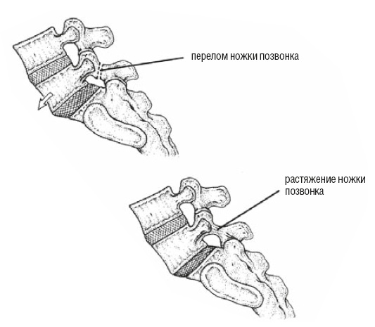 Иллюстрация к книге — Настольная книга для тех, у кого болит спина [i_168.jpg]