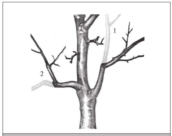 Иллюстрация к книге — Формирование и обрезка садовых деревьев [i_059.jpg]