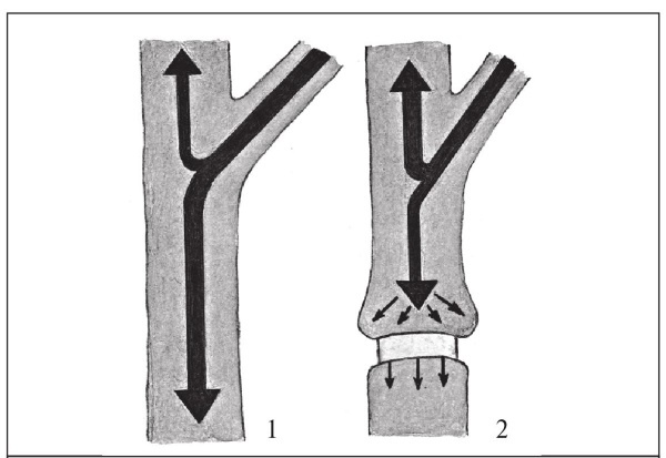 Иллюстрация к книге — Формирование и обрезка садовых деревьев [i_091.jpg]