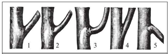 Иллюстрация к книге — Формирование и обрезка садовых деревьев [i_106.jpg]