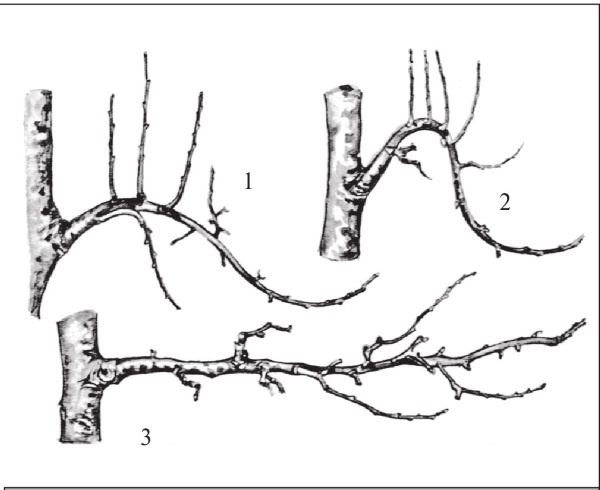 Иллюстрация к книге — Формирование и обрезка садовых деревьев [i_180.jpg]