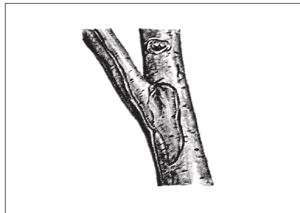 Иллюстрация к книге — Формирование и обрезка садовых деревьев [i_242.jpg]