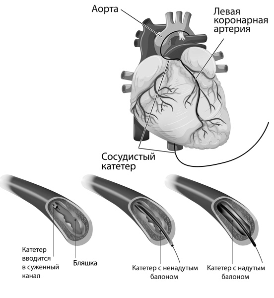Иллюстрация к книге — Мифы и заблуждения о сердце и сосудах [i_024.jpg]