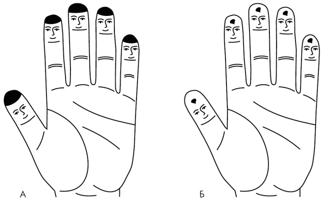 Иллюстрация к книге — Су-Джок лечит. Мигрень, кашель, боль в спине, тяжесть в желудке [i_013.jpg]