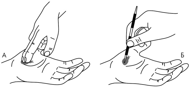 Иллюстрация к книге — Су-Джок лечит. Мигрень, кашель, боль в спине, тяжесть в желудке [i_017.jpg]