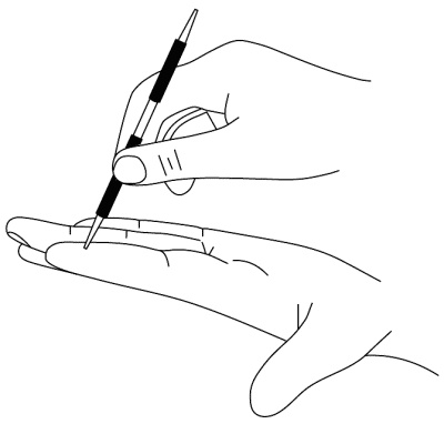 Иллюстрация к книге — Су-Джок лечит. Мигрень, кашель, боль в спине, тяжесть в желудке [i_030.jpg]