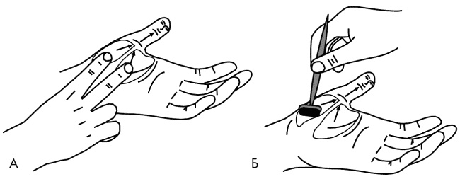 Иллюстрация к книге — Су-Джок лечит. Мигрень, кашель, боль в спине, тяжесть в желудке [i_043.jpg]