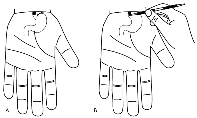 Иллюстрация к книге — Су-Джок лечит. Мигрень, кашель, боль в спине, тяжесть в желудке [i_063.jpg]