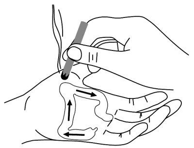 Иллюстрация к книге — Су-Джок лечит. Мигрень, кашель, боль в спине, тяжесть в желудке [i_070.jpg]