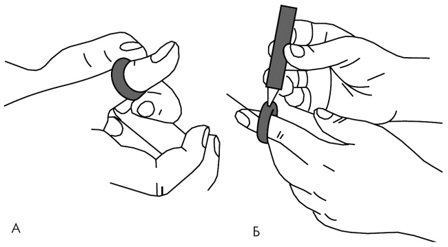 Иллюстрация к книге — Су-Джок лечит. Мигрень, кашель, боль в спине, тяжесть в желудке [i_083.jpg]