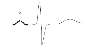 Иллюстрация к книге — Что показывает кардиограмма [i_006.jpg]