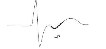 Иллюстрация к книге — Что показывает кардиограмма [i_009.jpg]