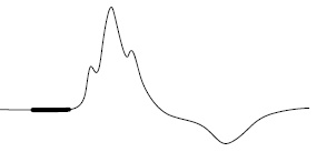 Иллюстрация к книге — Что показывает кардиограмма [i_010.jpg]