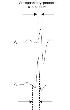 Иллюстрация к книге — Что показывает кардиограмма [i_011.jpg]