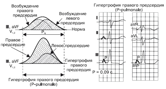 Иллюстрация к книге — Что показывает кардиограмма [i_014.jpg]