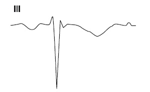 Иллюстрация к книге — Что показывает кардиограмма [i_018.jpg]