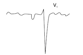 Иллюстрация к книге — Что показывает кардиограмма [i_019.jpg]