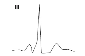 Иллюстрация к книге — Что показывает кардиограмма [i_022.jpg]
