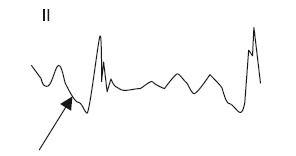 Иллюстрация к книге — Что показывает кардиограмма [i_023.jpg]