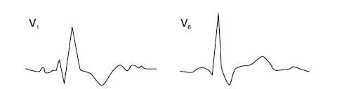 Иллюстрация к книге — Что показывает кардиограмма [i_028.jpg]