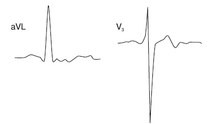 Иллюстрация к книге — Что показывает кардиограмма [i_031.jpg]