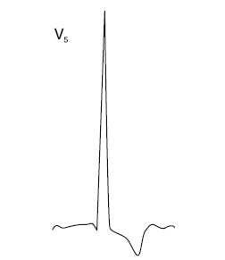 Иллюстрация к книге — Что показывает кардиограмма [i_032.jpg]