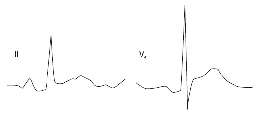 Иллюстрация к книге — Что показывает кардиограмма [i_037.jpg]