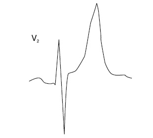 Иллюстрация к книге — Что показывает кардиограмма [i_040.jpg]