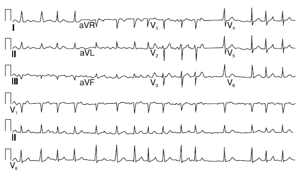 Иллюстрация к книге — Что показывает кардиограмма [i_042.jpg]