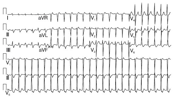 Иллюстрация к книге — Что показывает кардиограмма [i_043.jpg]