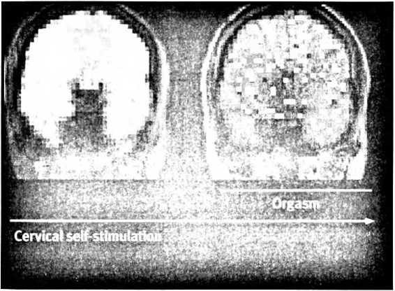 Иллюстрация к книге — Любовь и секс. Как мы ими занимаемся. Прямой репортаж из научных лабораторий, изучающих человеческую сексуальность [i_019.jpg]