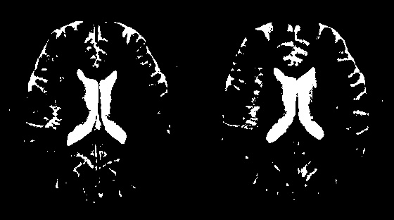 Иллюстрация к книге — Осторожно, спорт! О вреде бега, фитнеса и других физических нагрузок [img_16.jpg]