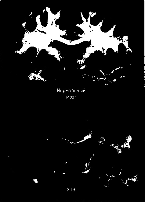 Иллюстрация к книге — Осторожно, спорт! О вреде бега, фитнеса и других физических нагрузок [img_18.jpg]