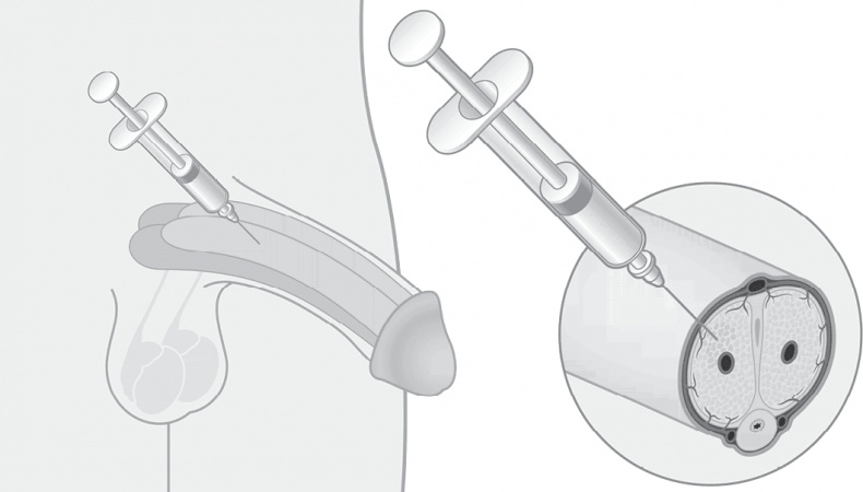 Иллюстрация к книге — ОН. Интимный разговор про тот самый орган [i_022.jpg]