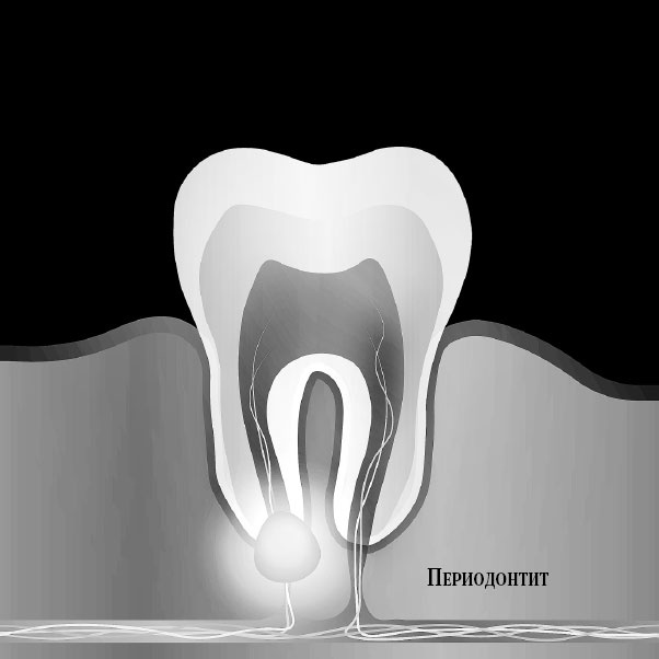 Иллюстрация к книге — Злые зубы [i_020.jpg]