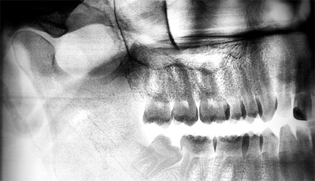 Иллюстрация к книге — Злые зубы [i_033.jpg]