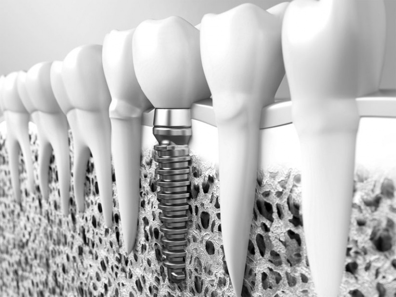 Иллюстрация к книге — Злые зубы [i_038.jpg]